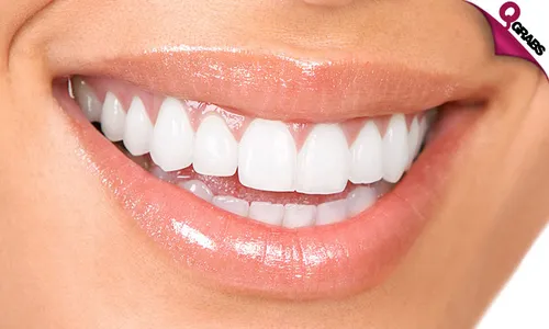 Teeth Whitening & More!